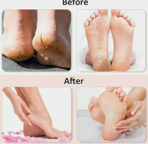 2 Pairs Silicone Moisturizing Socks & Gloves for Foot and Hand Care