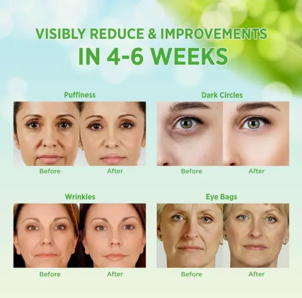 VELAMO ADVANCED Retinol Eye Patches for Dark Circles