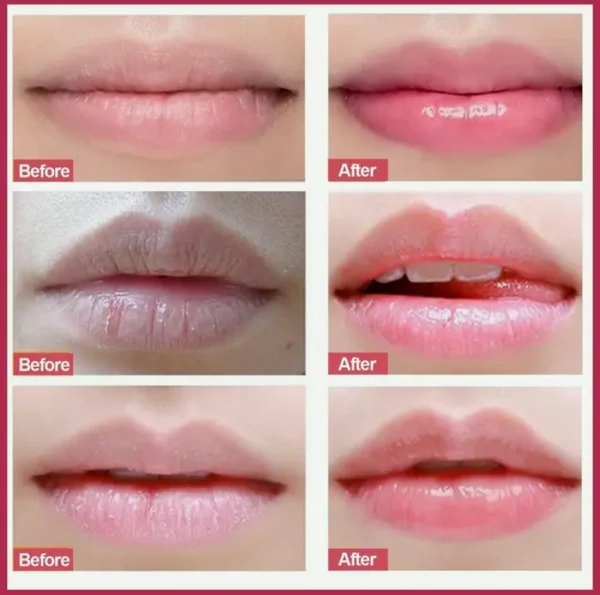 Lip Treatment Scrub, Natural Scrubber for Chapped Lips