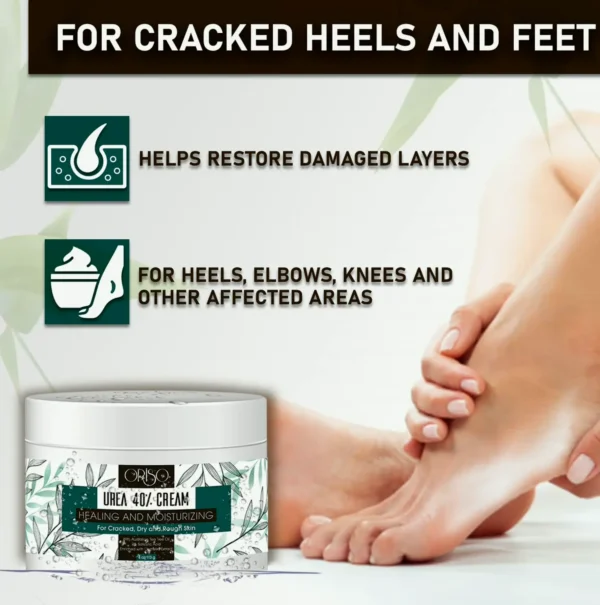 Urea Lotion 40% - Intensive Hydration for Parched Areas