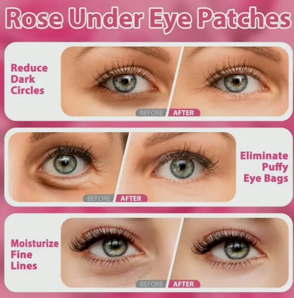 Rose Under Eye Patches - Dark Circles