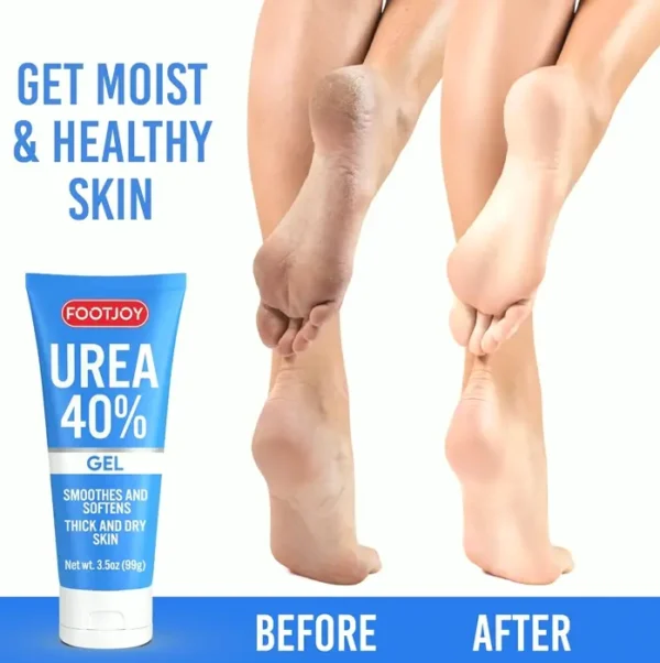 Urea Foot Gel 40% for Cracked Feet, Hands