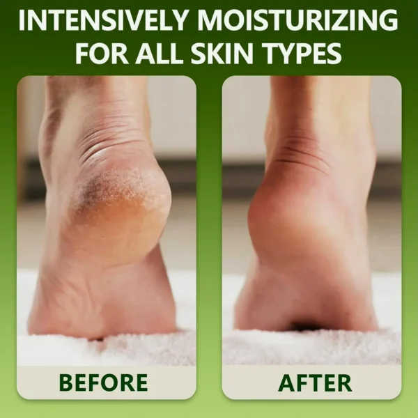 Natural Foot Cream - Restore Cracked Heels - 6.35 oz