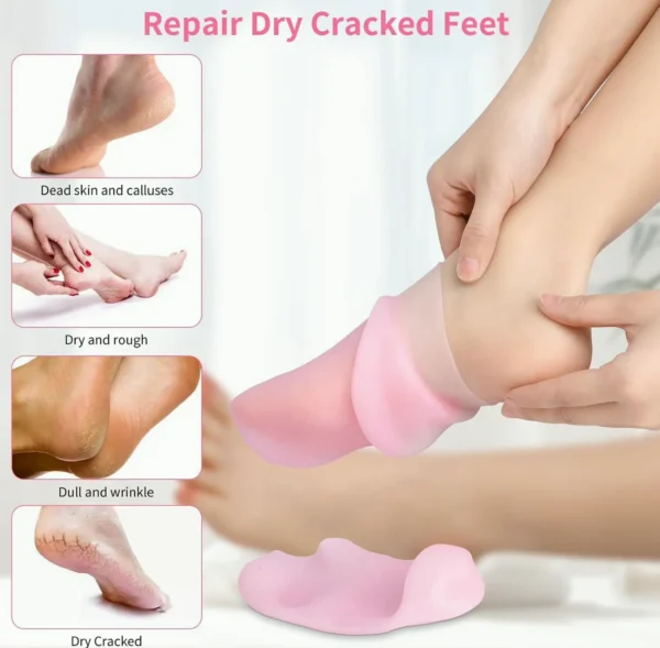 Moisturizing Gel Socks for Cracked Hands