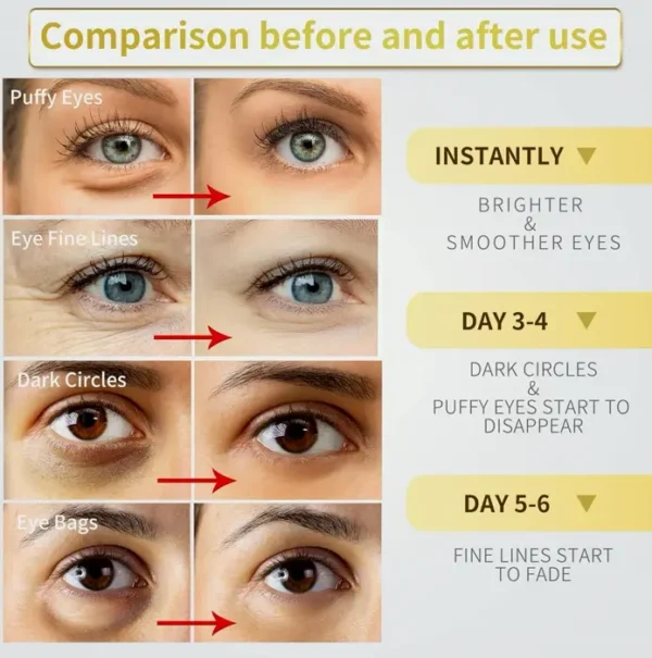 Below Occhi Mask - 60 Pcs - 24K Gold Eye Mask to Swollen Ojos & Shadowed Rings