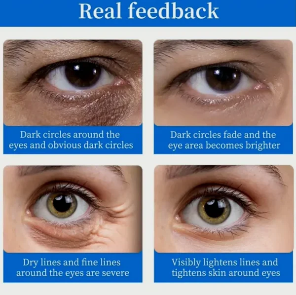 Beneath Eyes Patches (64 Pcs) – Chilling & Luminous Hyaluronic Acid Eye Care