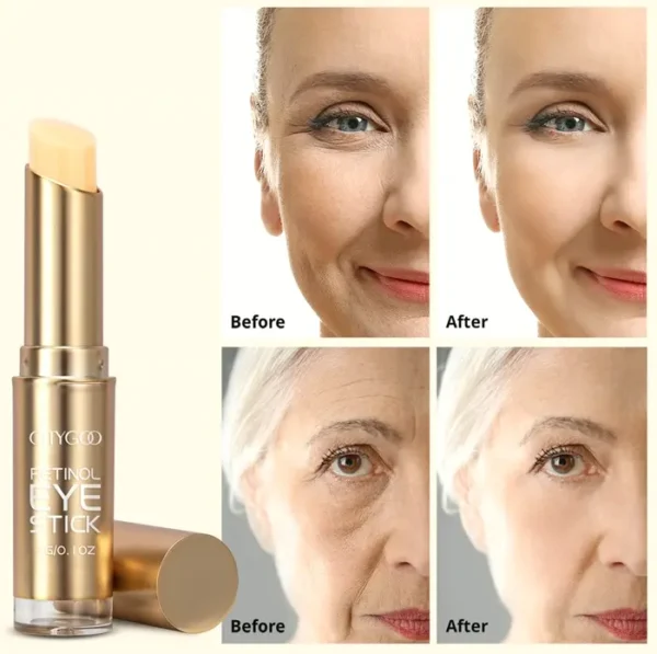 Vitamin A Eye Stick for Under-Eye Bags & Fine Lines