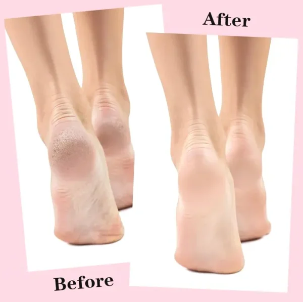 Two Pairs Moisturizing Footwear Ladies